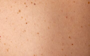 1 – Advanced Dermatological Diagnosis and Pathology