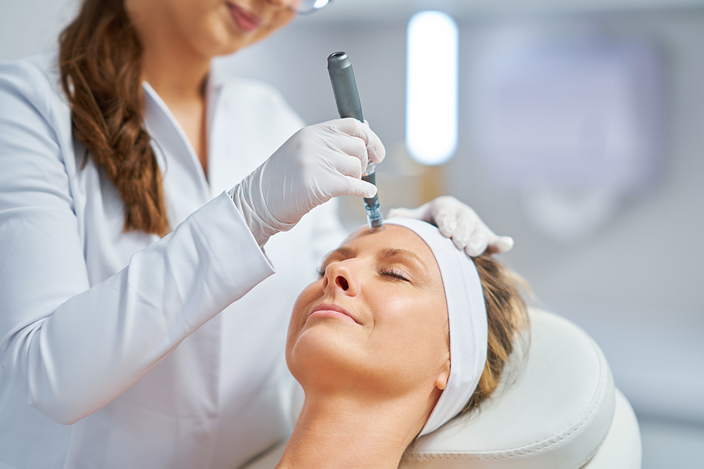 Healthcare professional practicing facial microneedling technique with PRP application on real patient model during AMEQ Academy hands-on training session in Montreal